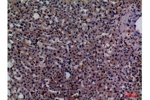 Immunohistochemistry (IHC) analysis of paraffin-embedded Human Liver, antibody was diluted at 1:100. (CD68 anticorps  (Internal Region))
