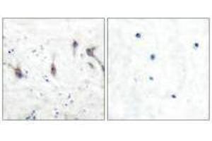 Immunohistochemical analysis of paraffin-embedded human brain tissue using ARC antibody.