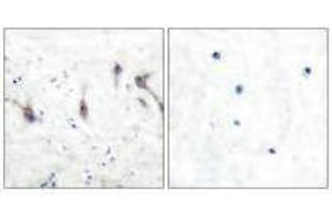 Immunohistochemical analysis of paraffin-embedded human brain tissue using ARC antibody. (ARC anticorps)