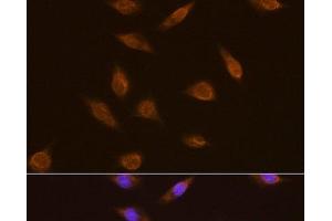 Immunofluorescence analysis of L929 cells using TSG101 Polyclonal Antibody at dilution of 1:100. (TSG101 anticorps)