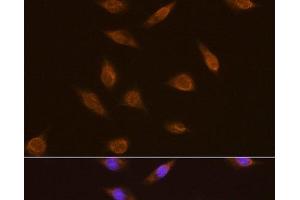 Immunofluorescence analysis of L929 cells using TSG101 Polyclonal Antibody at dilution of 1:100.