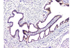 IHC analysis of RAB11B using anti-RAB11B antibody (ABIN6719364). (RAB11B anticorps)