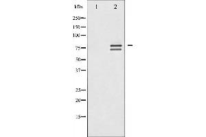 Western blot analysis of Lamin A/C expression in HeLa whole cell lysates,The lane on the left is treated with the antigen-specific peptide. (Lamin A/C anticorps  (Internal Region))