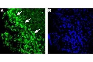 Expression of Histamine H1 receptor in mouse brain - Immunohistochemical staining of mouse ventromedial hypothalamus (VMH) using Anti-Histamine H1 Receptor (HRH1) Antibody (ABIN7043268, ABIN7044505 and ABIN7044506).