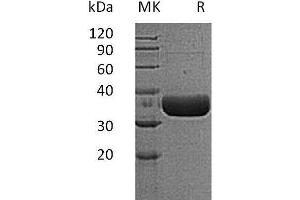 Western Blotting (WB) image for Tryptase beta 2 (TPSB2) protein (His tag) (ABIN7320763)