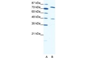 WB Suggested Anti-ZNF225 Antibody Titration:  0. (ZNF225 anticorps  (N-Term))