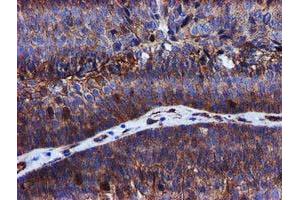 Image no. 4 for anti-Epsin 2 (EPN2) antibody (ABIN1498050)