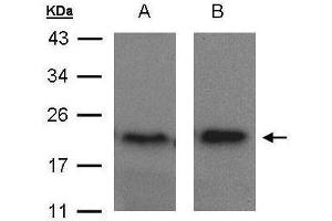 WB Image Sample(30 μg of whole cell lysate) A:MOLT4, B:Raji, 15% SDS PAGE antibody diluted at 1:1500 (ARF5 anticorps)