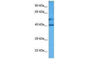 Host:  Rabbit  Target Name:  CKM  Sample Tissue:  Mouse Small Intestine  Antibody Dilution:  1ug/ml (CKM anticorps  (Middle Region))