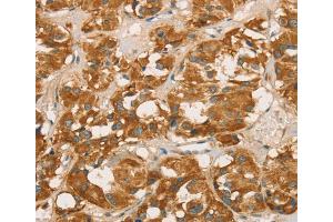Immunohistochemistry (IHC) image for anti-Retinoblastoma Binding Protein 8 (RBBP8) antibody (ABIN2423211) (Retinoblastoma Binding Protein 8 anticorps)