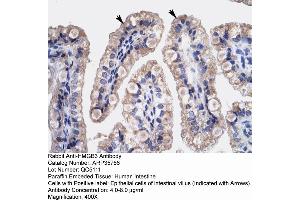 Human Intestine (HMGB3 anticorps  (C-Term))
