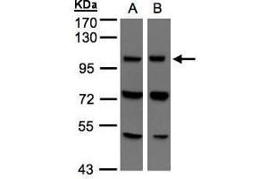 WB Image Sample(30 μg of whole cell lysate) A:293T B:Hep G2, 7.