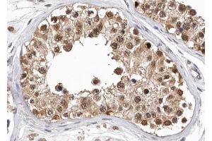 ABIN6268782 at 1/100 staining human testis tissue sections by IHC-P. (PKM anticorps  (Internal Region))