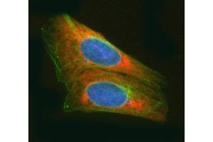 IF analysis of RARS/RARS1 using anti-RARS/RARS1 antibody (ABIN7600223) and anti-Tubulin Alpha antibody (ABIN7600339). (Probable Arginine--tRNA Ligase, Cytoplasmic (RARS-1) (AA 165-425) anticorps)