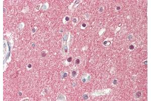 Rabbit Anti-SV2A antibody  Formalin Fixed Paraffin Embedded Tissue: Human Brain, Cortex Primary antibody Concentration: 1:100 Secondary Antibody: Donkey anti-Rabbit-Cy3 Secondary Antibody Concentration: 1:200 Magnification: 20x Exposure Time: 0. (SV2A anticorps  (Middle Region))