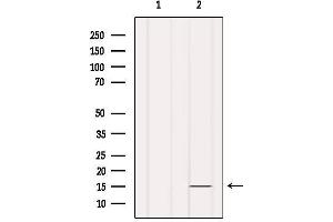 Western blot analysis of extracts from Hela, using INSL5 Antibody. (INSL5 anticorps)