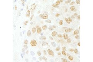 Immunohistochemistry (IHC) image for anti-CDC5 Cell Division Cycle 5-Like (S. Pombe) (CDC5L) (AA 752-802) antibody (ABIN7453824)