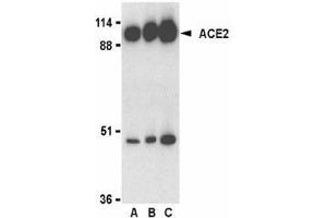 Western blot analysis of ACE2 in human kidney lysate with AP30007PU-N ACE2 antibody at 0. (ACE2 anticorps  (C-Term))