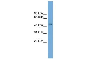 WB Suggested Anti-ERCC8 Antibody Titration: 0. (ERCC8 anticorps  (Middle Region))