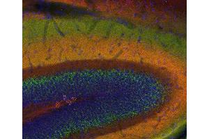 Indirect immunostaining of a PFA fixed mouse hippocampus section with anti-SNAP 25 (dilution 1 : 200; red) and guinea pig anti-VGluT 2 (cat. (SNAP25 anticorps  (AA 192-206))