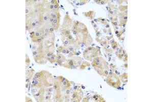 Immunohistochemistry of paraffin-embedded human stomach using CETN3 antibody. (CETN3 anticorps  (AA 1-167))