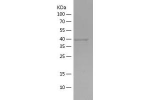 Western Blotting (WB) image for Actin, Alpha, Cardiac Muscle 1 (ACTC1) (AA 236-368) protein (His-IF2DI Tag) (ABIN7121660)