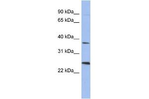 WB Suggested Anti-MAGEB2 Antibody Titration: 0. (MAGEB2 anticorps  (N-Term))