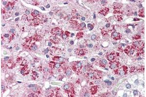 Adrenal, Human: Formalin-Fixed, Paraffin-Embedded (FFPE) (NTSR2 anticorps  (Internal Region))
