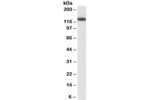 Western blot testing of NIH3T3 lysate with MYO1B antibody at 1ug/ml. (Myosin IB anticorps)