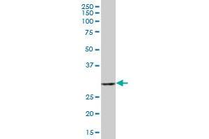 CKAP1 MaxPab polyclonal antibody. (TBCB anticorps  (AA 1-244))