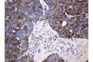 Image no. 5 for anti-Galactosidase, beta 1 (GLB1) antibody (ABIN1498467)