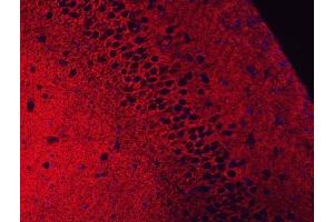 IF analysis of EAAT2/GLT-1/SLC1A2 using anti-EAAT2/GLT-1/SLC1A2 antibody (ABIN3043436).