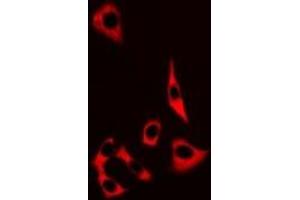 Immunofluorescent analysis of MRP8 staining in MCF7 cells.