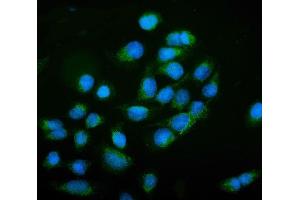 IF analysis of NCAM1 using anti-NCAM1 antibody (ABIN7602512).