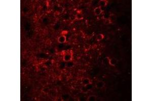 Immunofluorescence of CCDC55 in mouse brain cells with CCDC55 antibody at 20 ug/mL.