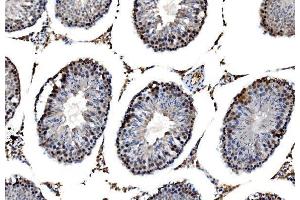 IHC analysis of RRS1 using anti-RRS1 antibody (ABIN7601344).
