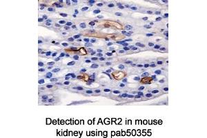 Image no. 3 for anti-Anterior Gradient Homolog 2 (Xenopus Laevis) (AGR2) (AA 50-100) antibody (ABIN363664)