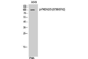 Western Blotting (WB) image for anti-Polycystic Kidney Disease 1/2/3 (PKD1/2/3) (pSer738), (pSer742) antibody (ABIN3182590) (PKD1/2/3 anticorps  (pSer738, pSer742))
