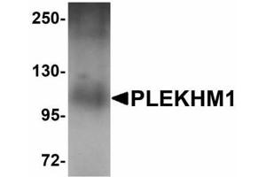 Image no. 1 for anti-Pleckstrin Homology Domain Containing, Family M (With RUN Domain) Member 1 (PLEKHM1) (N-Term) antibody (ABIN478196) (PLEKHM1 anticorps  (N-Term))