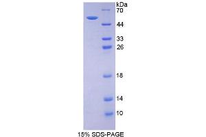 SDS-PAGE analysis of Mouse Estrogen Receptor 2 Protein. (ESR2 Protéine)