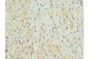 Immunohistochemistry of paraffin-embedded human liver tissue using ABIN7155891 at dilution of 1:100 (HGD anticorps  (AA 226-445))