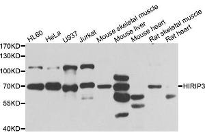 Western blot analysis of extracts of various cell lines, using HIRIP3 antibody. (HIRIP3 anticorps)