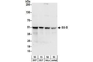 Western Blotting (WB) image for anti-Sjogren Syndrome Antigen B (SSB) (AA 358-408) antibody (ABIN7453946) (SSB anticorps  (AA 358-408))