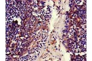 Immunohistochemistry of paraffin-embedded human tonsil tissue using ABIN7159312 at dilution of 1:100 (MFI2 anticorps  (AA 20-302))