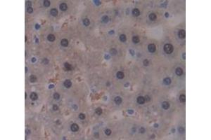 IHC-P analysis of Rat Tissue, with DAB staining. (GALT anticorps  (AA 1-379))