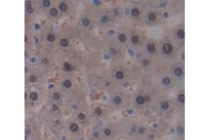 IHC-P analysis of Rat Tissue, with DAB staining. (GALT anticorps  (AA 1-379))