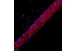 Immunofluorescence (IF) image for anti-Chloride Intracellular Channel 6 (CLIC6) antibody (ABIN7073478)