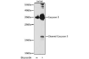 Western blot analysis of extracts of Jurkat cells, using CASP3 antibody (ABIN6292881) at 1:1000 dilution. (Caspase 3 anticorps)
