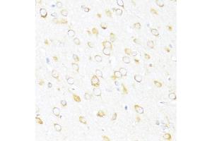 Immunohistochemistry of paraffin-embedded rat brain using DDX3Y antibody (ABIN6130260, ABIN6139496, ABIN6139497 and ABIN6215395) at dilution of 1:100 (40x lens).