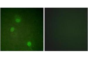 Immunofluorescence analysis of HeLa cells, using AurB (Ab-232) Antibody. (Aurora Kinase B anticorps  (AA 198-247))